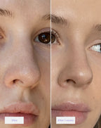 Nose Patches - Vakna med rena porer
