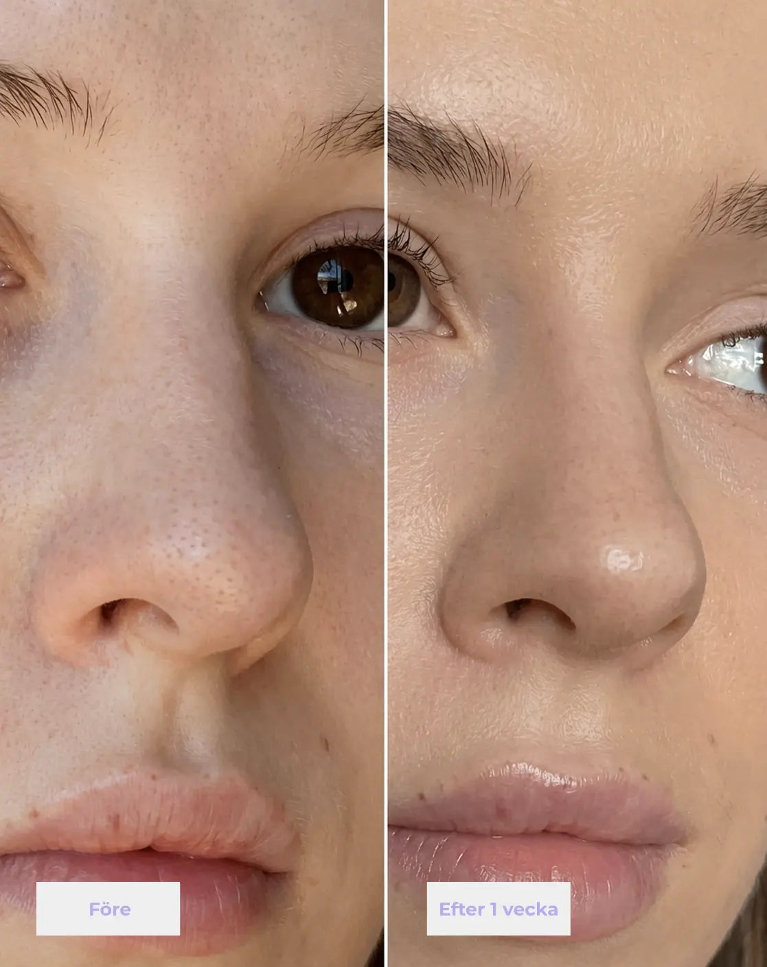 Nose Patches - Vakna med rena porer